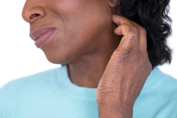 How I Treated My Chapped Skin In 24 Hours