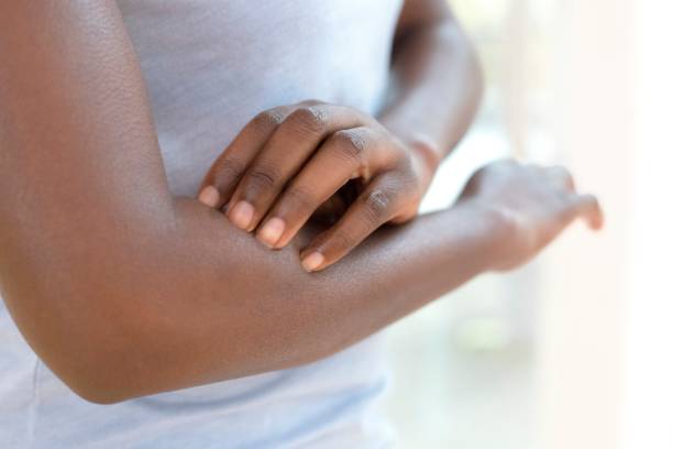 Doctors Couldn’t Explain My Skin Itch, But a Traditional Remedy Worked in Days